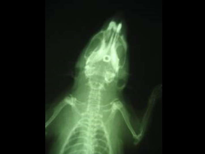 Micrografia A Raggi X Dellimpianto In Titanio